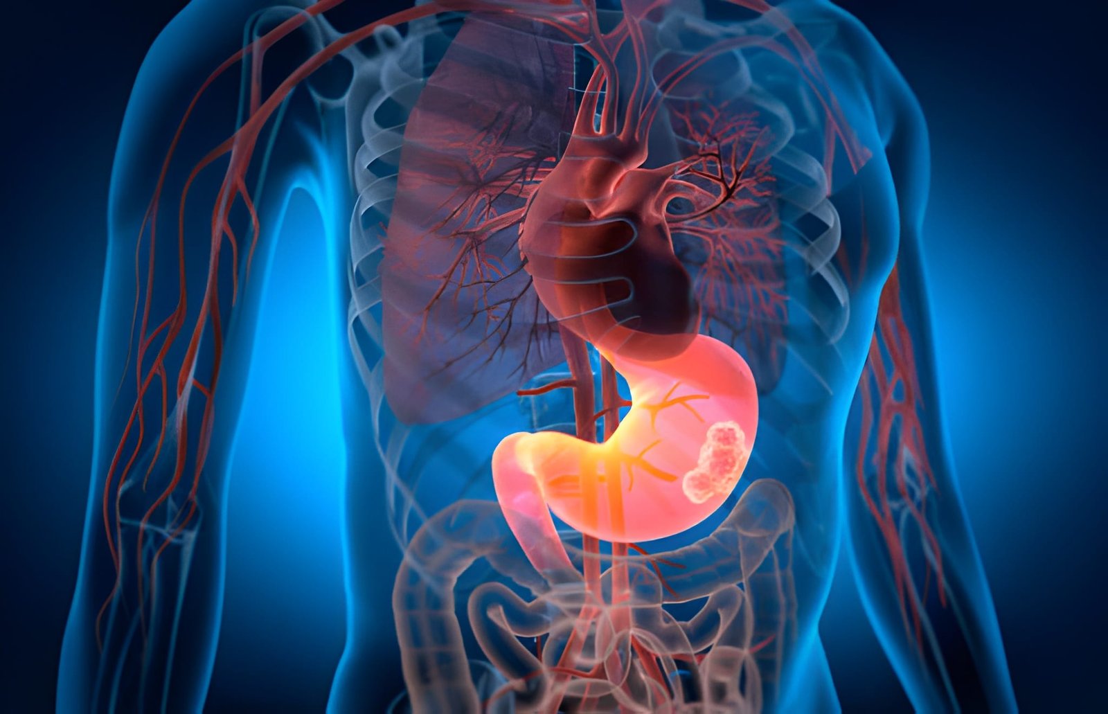 Stomach Cancer Treatment